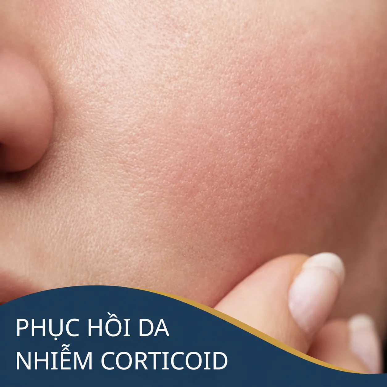 Phục hồi da
