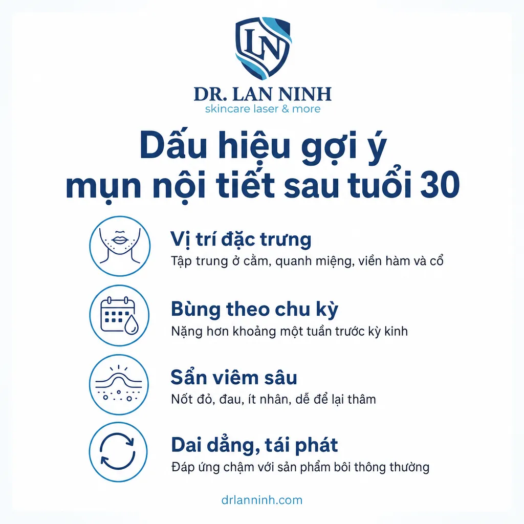 Dấu hiệu nhận biết mụn nội tiết sau tuổi 30: vị trí cằm viền hàm, bùng theo chu kỳ, sẩn viêm sâu, dai dẳng tái phát