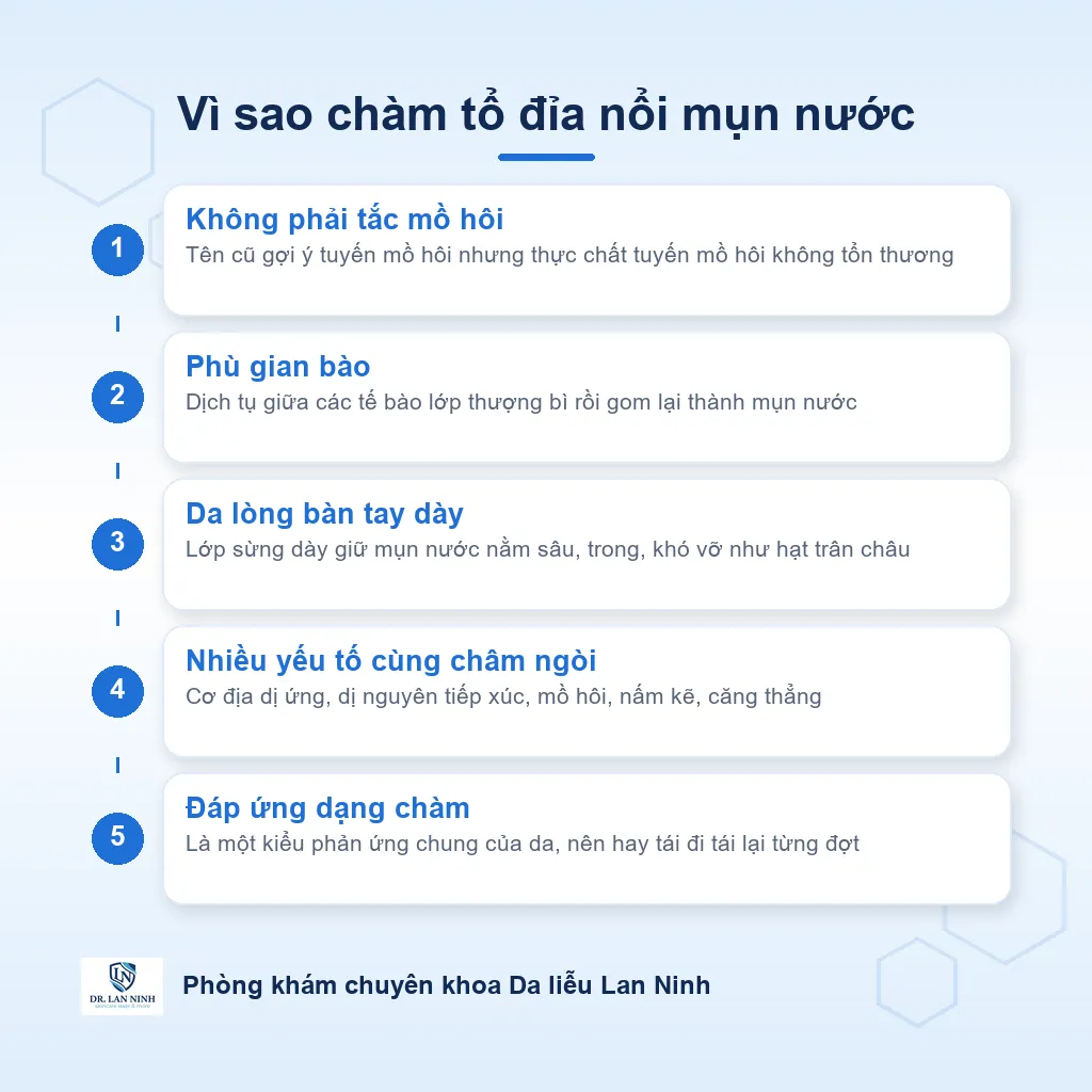 Sơ đồ cơ chế chàm tổ đỉa: phù gian bào trong lớp thượng bì tạo mụn nước ở lòng bàn tay, không phải do tắc tuyến mồ hôi