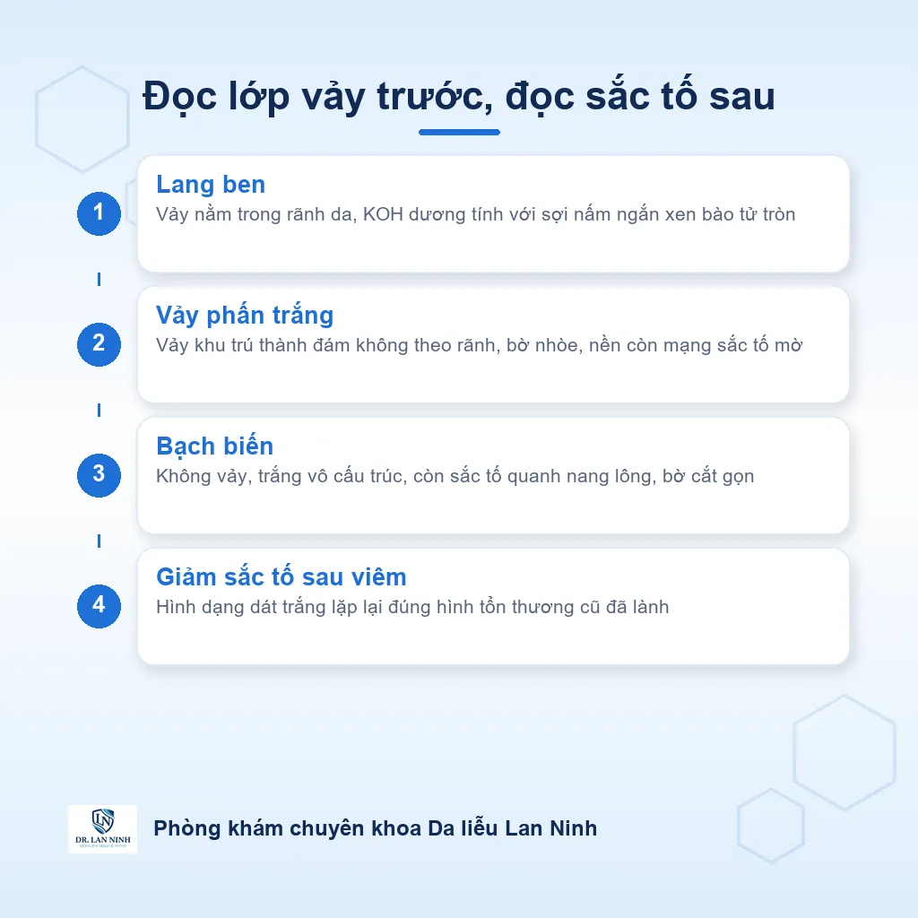 Sơ đồ phân biệt dát trắng trên mặt trẻ nhỏ theo vị trí lớp vảy và phần sắc tố còn lại: lang ben có vảy nằm trong rãnh da và KOH dương tính, vảy phấn trắng có vảy khu trú thành đám với KOH âm tính, bạch biến không có vảy và còn sắc tố quanh nang lông.