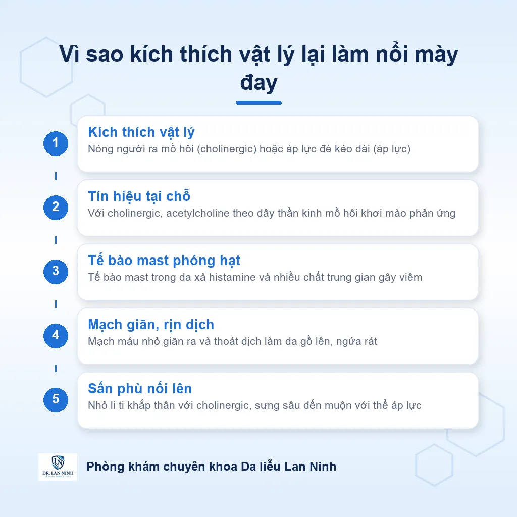 Sơ đồ cơ chế mày đay vật lý: kích thích nóng hoặc áp lực làm tế bào mast phóng histamine gây giãn mạch và nổi sẩn phù