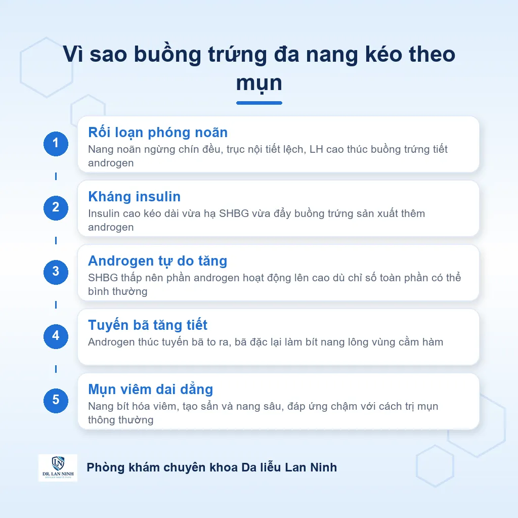Sơ đồ vòng nối buồng trứng đa nang và mụn nội tiết: androgen buồng trứng tăng, kháng insulin hạ SHBG, androgen tự do lên, tuyến bã tăng tiết dẫn tới mụn viêm