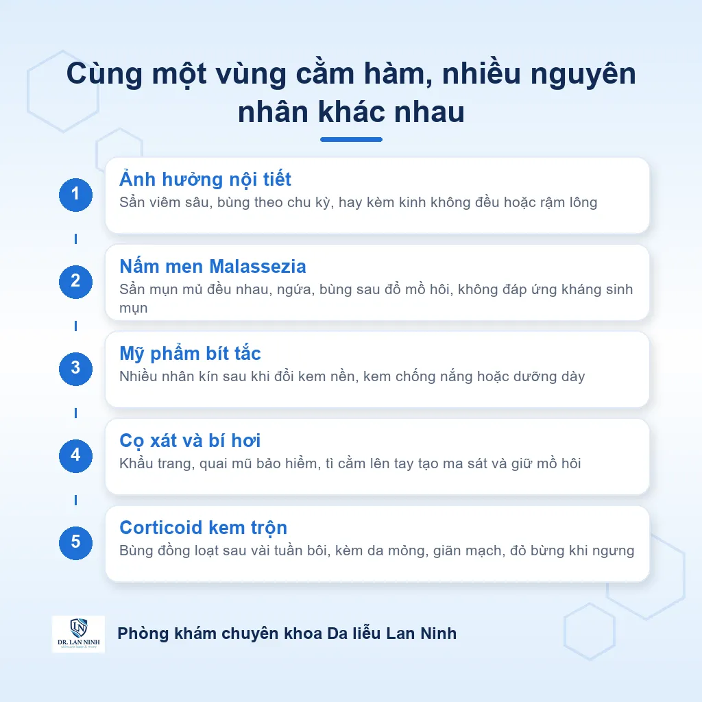 Sơ đồ các nguyên nhân gây mụn ở cằm quai hàm: nội tiết androgen, nấm men, mỹ phẩm bít tắc, cọ xát khẩu trang và corticoid, cho thấy vị trí không chỉ ra được nguyên nhân