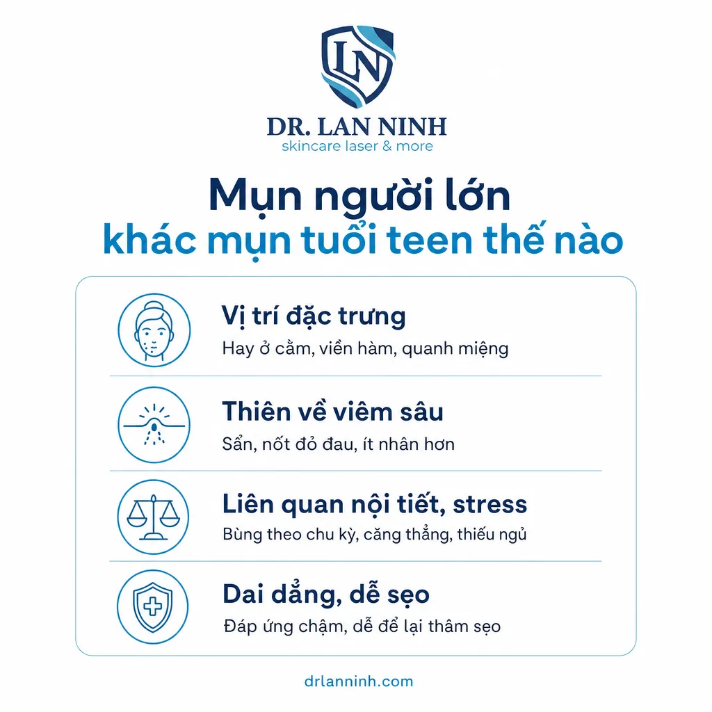Mụn trứng cá ở người lớn khác mụn tuổi teen: vị trí phần dưới mặt, viêm sâu, liên quan nội tiết, dai dẳng dễ sẹo