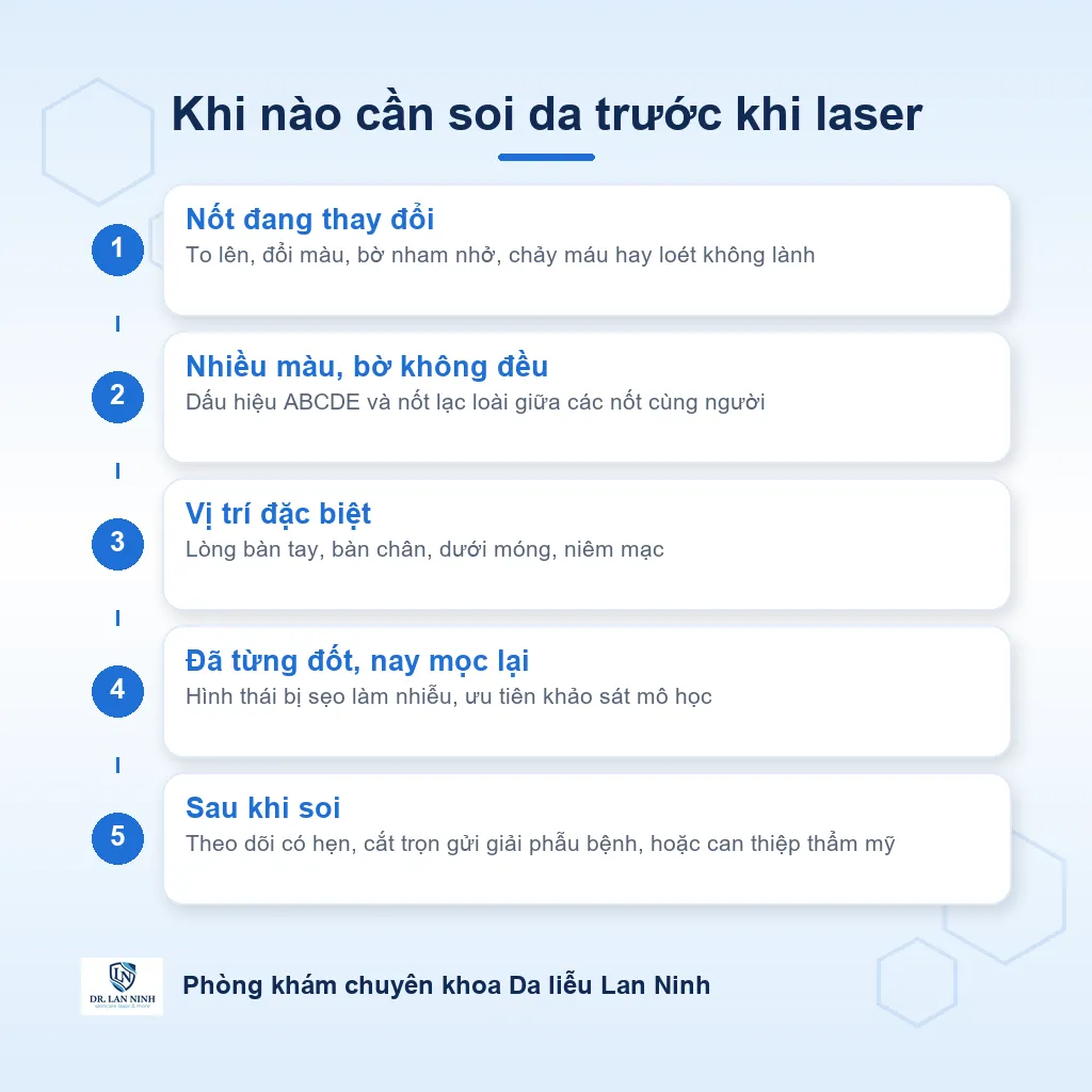 Sơ đồ khi nào cần soi da trước khi laser nốt ruồi hoặc mụn thịt: dấu hiệu ABCDE, vị trí đặc biệt như lòng bàn tay bàn chân và dưới móng, nốt từng bị đốt nay mọc lại, và các hướng xử trí sau khi soi
