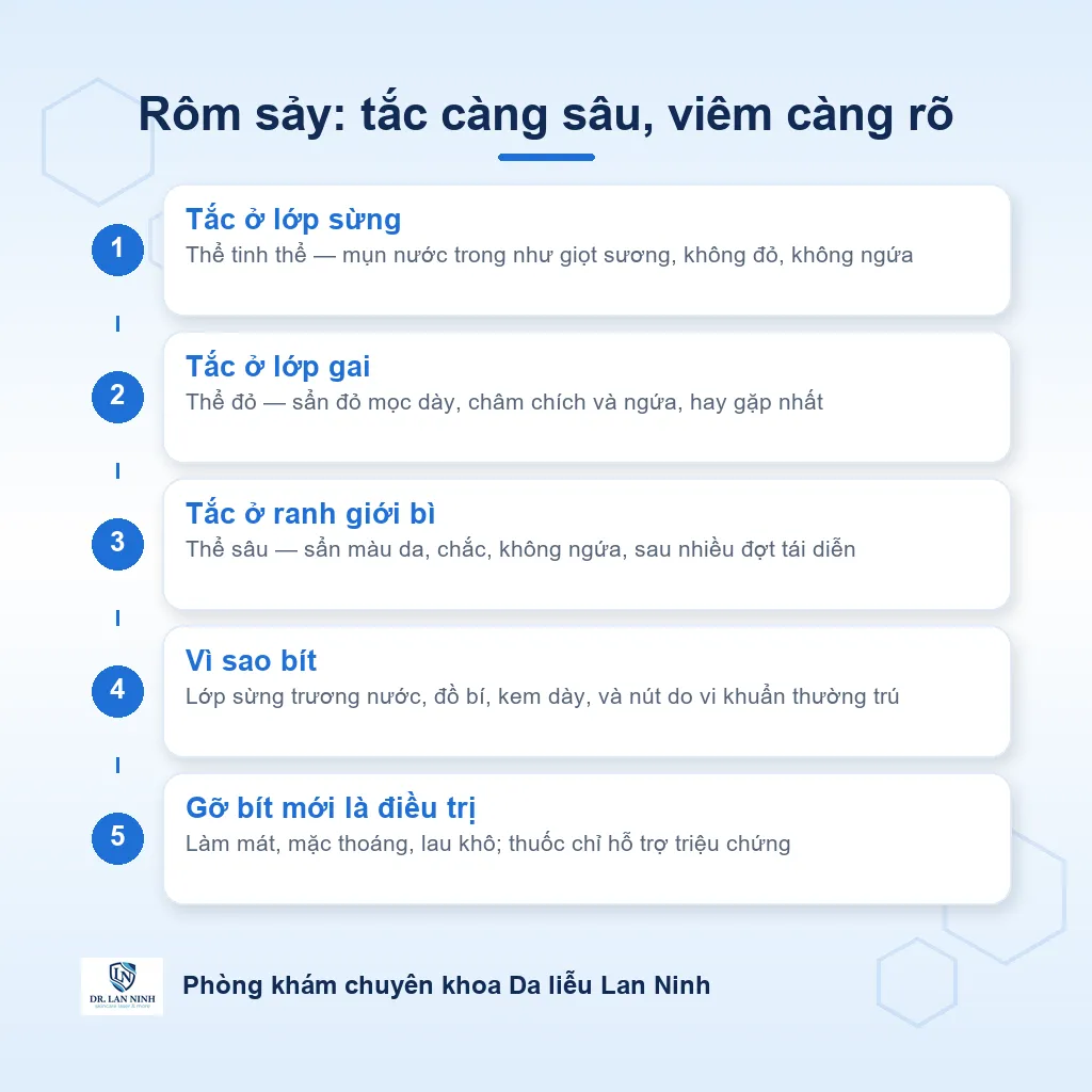 Sơ đồ ba thể rôm sảy theo độ sâu chỗ tắc ống tuyến mồ hôi: thể tinh thể tắc ở lớp sừng, thể đỏ tắc ở lớp gai, thể sâu tắc ở ranh giới bì và thượng bì, kèm biểu hiện tương ứng