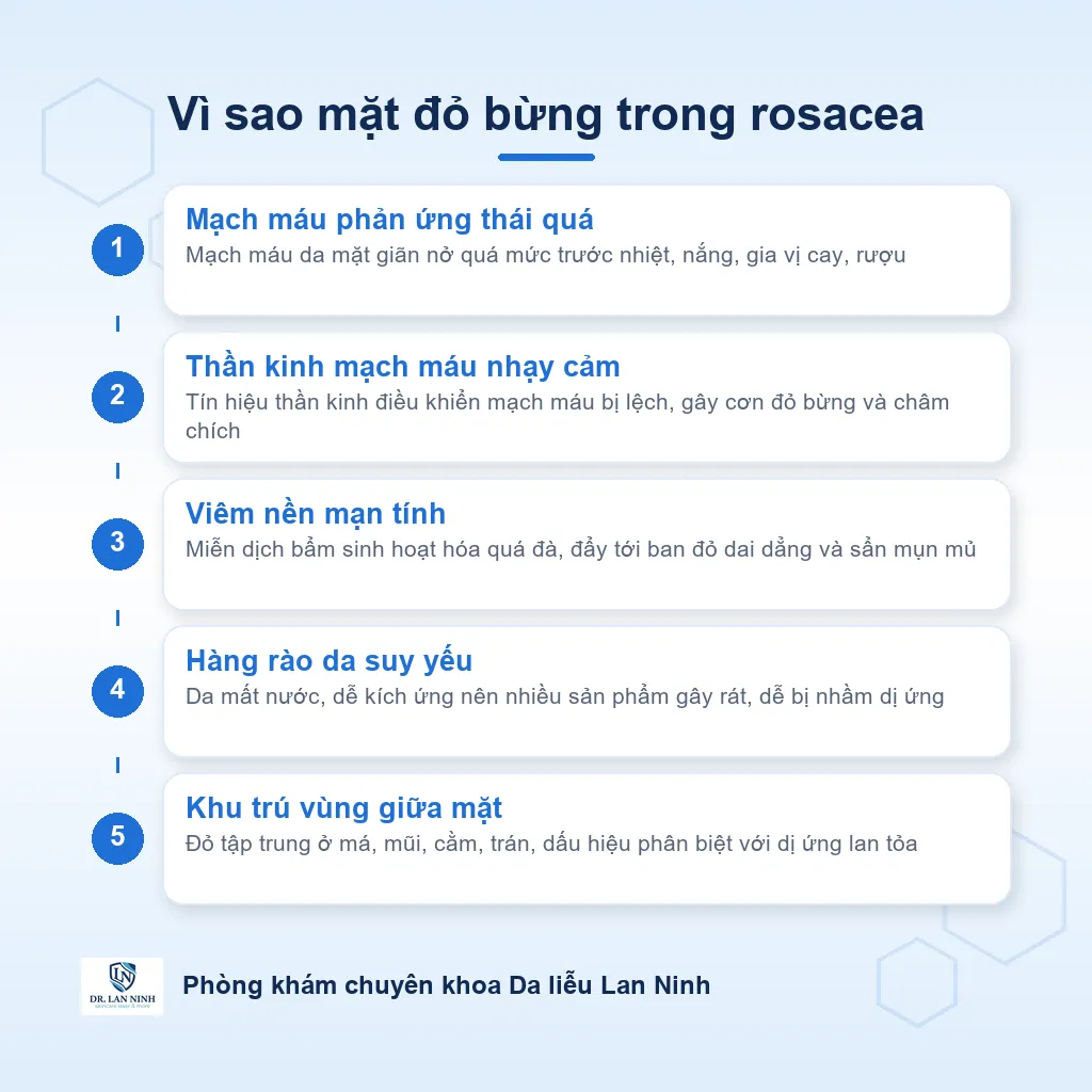Sơ đồ cơ chế rosacea: hệ thần kinh mạch máu phản ứng quá mức gây đỏ bừng, viêm và giãn mạch ở vùng trung tâm mặt