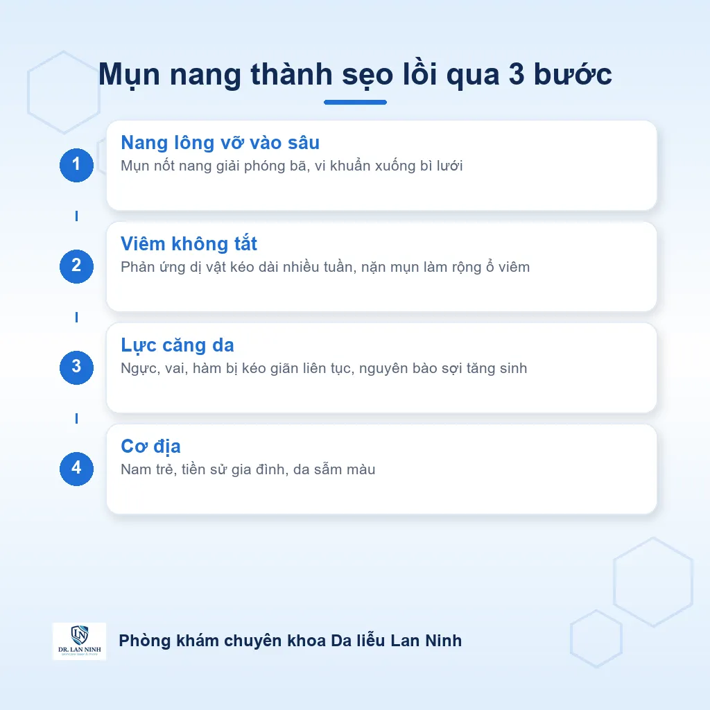 Sơ đồ cơ chế hình thành sẹo lồi sau mụn ở ngực, vai và góc hàm
