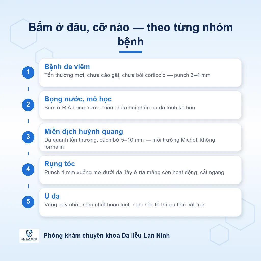 Sơ đồ chọn vị trí lấy mẫu sinh thiết punch theo từng nhóm bệnh da: bệnh da viêm lấy tổn thương mới, bệnh bọng nước lấy rìa bọng nước, miễn dịch huỳnh quang lấy da quanh tổn thương, rụng tóc lấy rìa mảng còn hoạt động.
