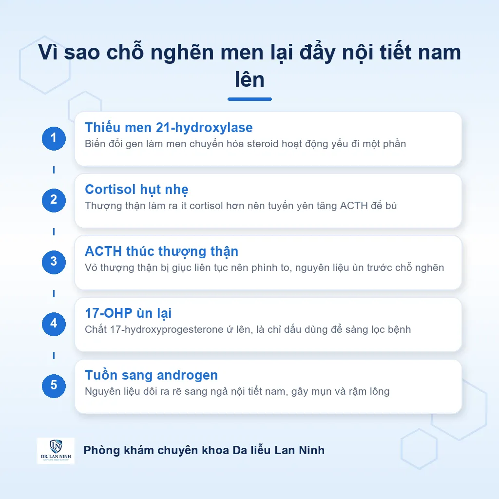 Sơ đồ cơ chế tăng sản thượng thận bẩm sinh không điển hình: thiếu men 21-hydroxylase, ACTH tăng, 17-OHP dồn ứ rồi tuồn sang androgen gây mụn và rậm lông