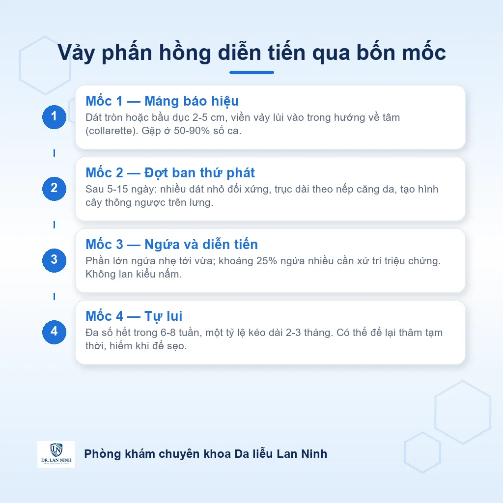 Sơ đồ diễn tiến vảy phấn hồng (pityriasis rosea): mảng báo hiệu xuất hiện trước, một tới hai tuần sau nổi đợt ban thứ phát xếp theo nếp da thành hình cây thông ngược, rồi tự lui trong sáu tới tám tuần