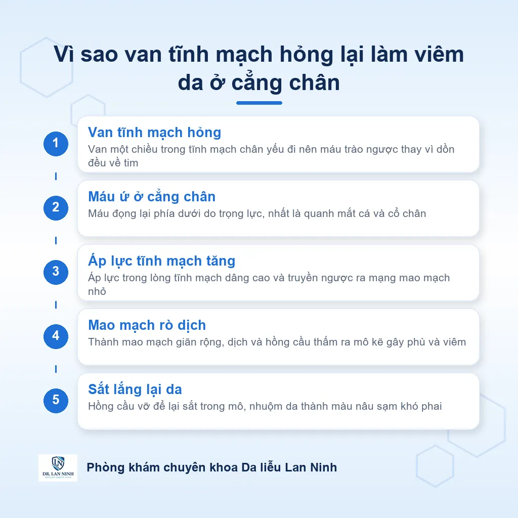 Sơ đồ cơ chế viêm da ứ đọng: van tĩnh mạch hỏng làm máu ứ, áp lực trong tĩnh mạch cẳng chân tăng, dịch và hồng cầu thấm ra mô gây viêm và lắng sắt nâu trên da