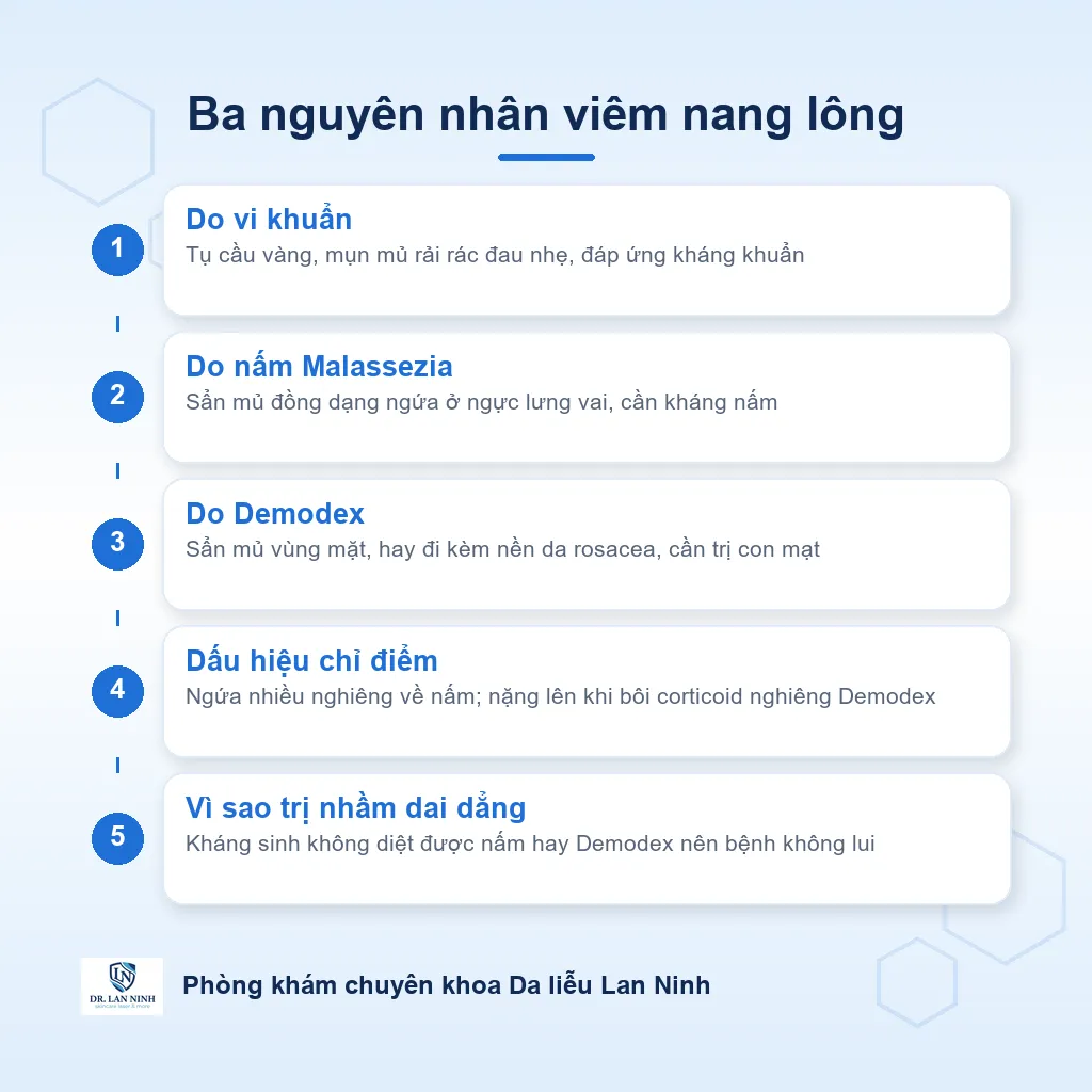 Sơ đồ đối chiếu ba nguyên nhân viêm nang lông: vi khuẩn, nấm Malassezia và Demodex khác nhau về vị trí và cách trị