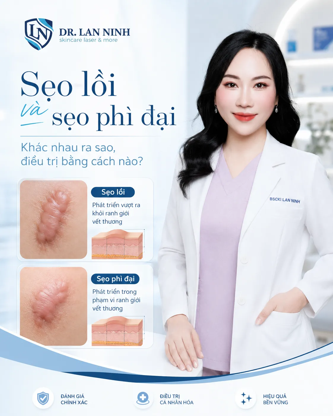 Điều trị sẹo lồi