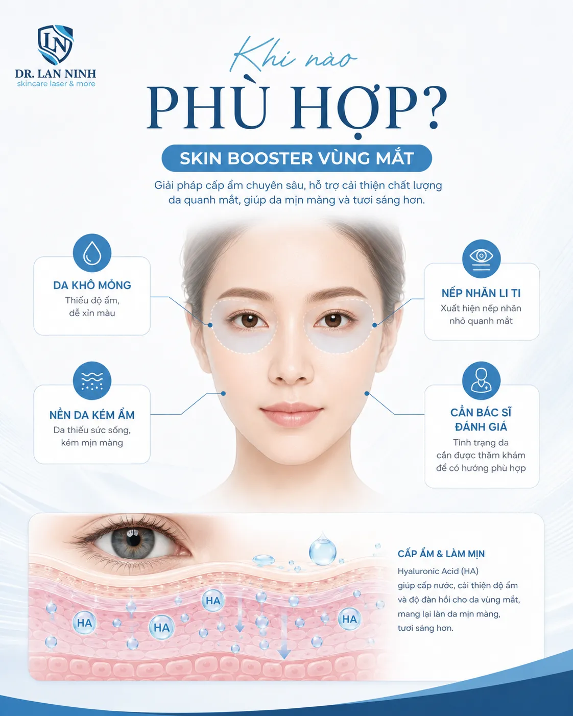 Tiêm skin booster vùng mắt: chỉ định, giới hạn và nguy cơ cần biết