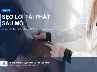 SẸO LỒI TÁI PHÁT SAU PHẪU THUẬT CẮT BỎ: VÌ SAO CẮT ĐƠN THUẦN KHÔNG ĐỦ