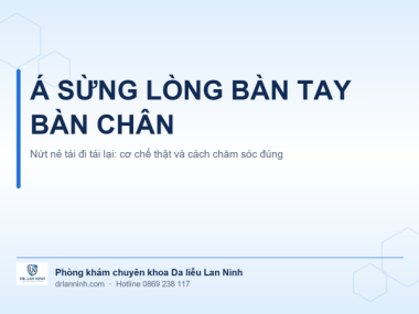 Á SỪNG LÒNG BÀN TAY BÀN CHÂN: NỨT NẺ TÁI ĐI TÁI LẠI