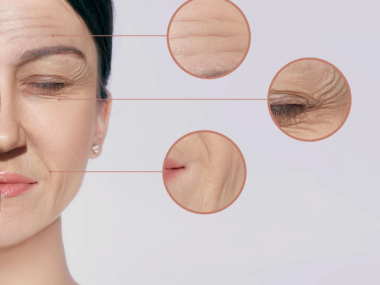 BOTOX TRONG TRẺ HÓA DA HIỆN ĐẠI: KHÔNG CÒN LÀ “ĐƠ MẶT” NHƯ NHIỀU NGƯỜI NGHĨ