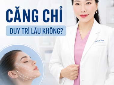Căng chỉ có duy trì lâu không tại Bình Dương