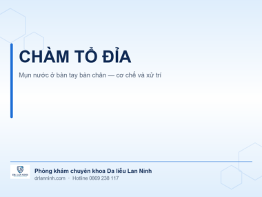 CHÀM TỔ ĐỈA Ở BÀN TAY BÀN CHÂN: CƠ CHẾ VÀ XỬ TRÍ