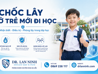 CHỐC LÂY Ở TRẺ MỚI ĐI HỌC: NHẬN BIẾT, ĐIỀU TRỊ, PHÒNG LÂY