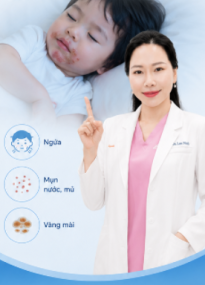 Chốc Lở Ở Trẻ Em: Khi Nào Cần Thuốc Bôi, Khi Nào Uống?