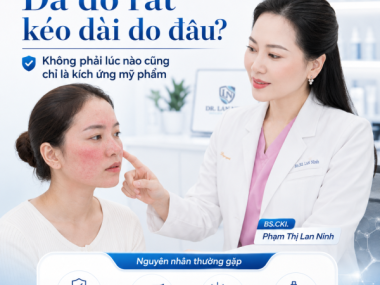 Da đỏ rát kéo dài ở Thủ Dầu Một: phân biệt kích ứng mỹ phẩm, rosacea và nhiễm corticoid