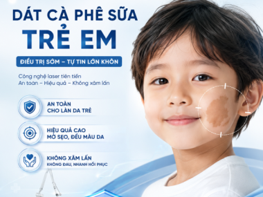 Dát cà phê sữa ở trẻ: khi nào theo dõi, khi nào cần khám?