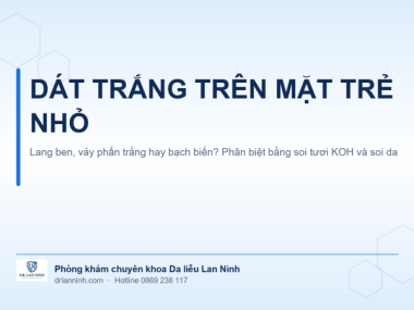 DÁT TRẮNG TRÊN MẶT TRẺ NHỎ: LANG BEN, VẢY PHẤN TRẮNG HAY BẠCH BIẾN?