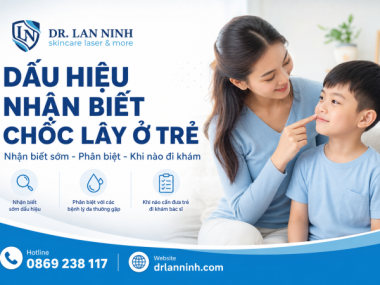 DẤU HIỆU NHẬN BIẾT CHỐC LÂY Ở TRẺ EM TẠI BÌNH DƯƠNG