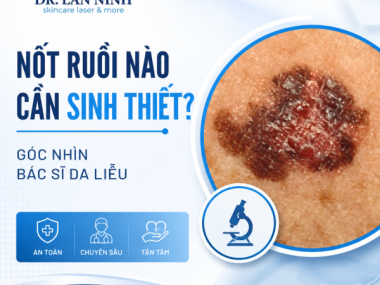 DẤU HIỆU TỔN THƯƠNG DA CẦN SINH THIẾT CẢNH BÁO UNG THƯ