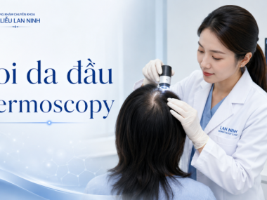 Dermoscopy trong bệnh lý rụng tóc: Khi nào nên soi da đầu tại Thủ Dầu Một?