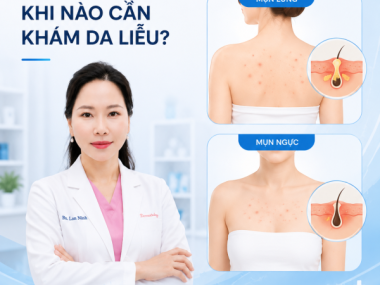 Điều trị mụn lưng mụn ngực tại Thủ Dầu Một Bình Dương: khi nào cần khám?