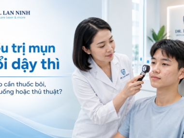 Điều trị mụn tuổi dậy thì: Khi nào cần thuốc bôi, thuốc uống hoặc thủ thuật?