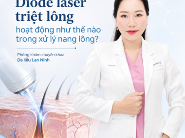 Diode laser triệt lông tại Thủ Dầu Một: cơ chế xử lý nang lông