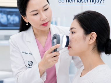 Đốm nâu trên mặt có nên laser ngay không? Khám và soi da trước điều trị tại Thủ Dầu Một, Bình Dương