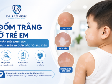 Đốm trắng ở trẻ em: lang ben, bạch biến hay giảm sắc tố?