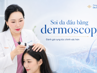 Đường kính sợi tóc và dấu hiệu tóc bị thu nhỏ  Một trong những dấu hiệu quan trọng khi soi da đầu là sự khác biệt đường kính giữa các sợi tóc. Ở người bình thường, các sợi tóc trong cùng một vùng có thể không hoàn toàn bằng nhau, nhưng sự chênh lệch thườn