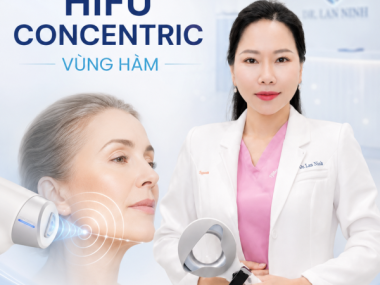 HIFU Concentric Cho Vùng Đường Viền Hàm Tại Thủ Dầu Một: Phù Hợp Với Kiểu Chảy Xệ Nào?