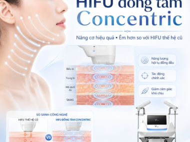 HIFU là gì? Cơ chế nâng cơ không phẫu thuật tại Thủ Dầu Một, Bình Dương