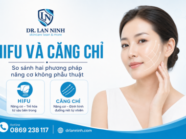 HIFU VÀ CĂNG CHỈ: SO SÁNH HAI PHƯƠNG PHÁP NÂNG CƠ