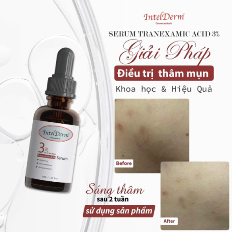 Intelderm Tranexamic acid 3%