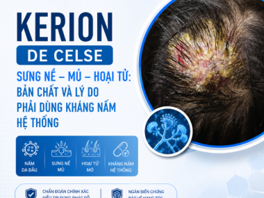 KERION DE CELSE SƯNG NỀ MỦ HOẠI TỬ: BẢN CHẤT VÀ LÝ DO PHẢI DÙNG KHÁNG NẤM HỆ THỐNG