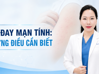 MỀ ĐAY MẠN TÍNH: NHỮNG ĐIỀU CẦN BIẾT VÀ KHI NÀO ĐI KHÁM