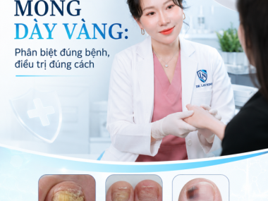 Móng dày vàng: phân biệt nấm, vảy nến, chấn thương