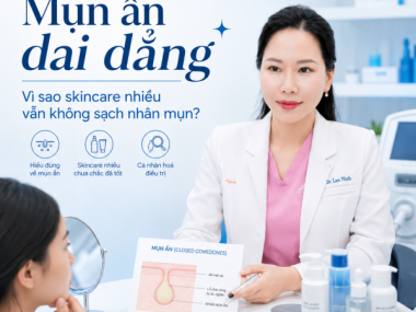 Mụn ẩn dai dẳng tại Bình Dương: Vì sao skincare nhiều vẫn không sạch nhân mụn?