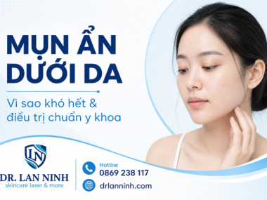 MỤN ẨN DƯỚI DA: VÌ SAO KHÓ HẾT, ĐIỀU TRỊ CHUẨN Y KHOA