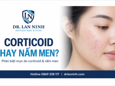 MỤN DO CORTICOID VÀ MỤN NẤM MEN KHÁC NHAU THẾ NÀO?
