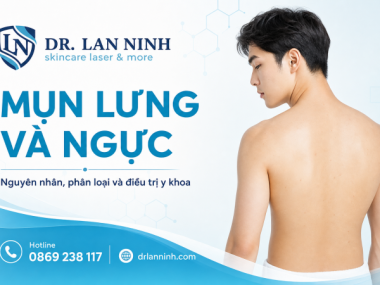MỤN LƯNG VÀ NGỰC: NGUYÊN NHÂN, PHÂN LOẠI VÀ ĐIỀU TRỊ