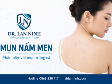 MỤN NẤM MEN LÀ GÌ? CÁCH PHÂN BIỆT VỚI MỤN TRỨNG CÁ